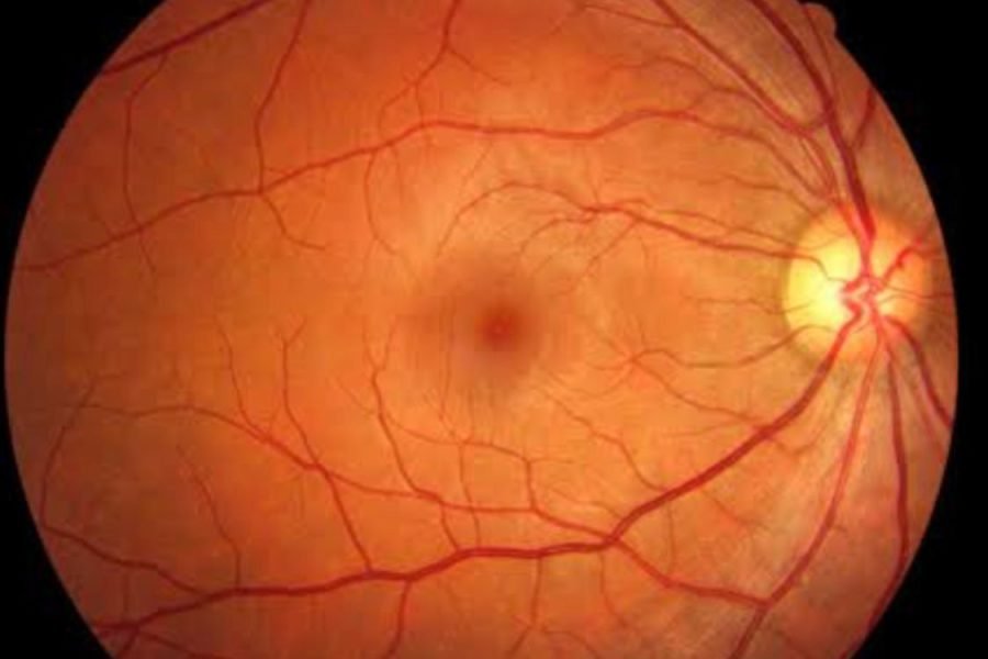img-doenca-da-retina